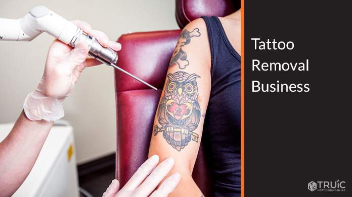 Tattoo Removal Business Image